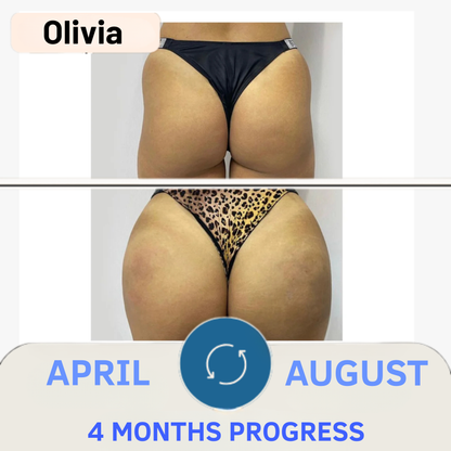 CurvBoost - Buttocks & Hips Gummies